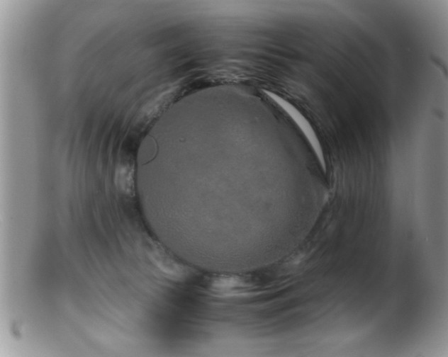 X0000099510177200805151509