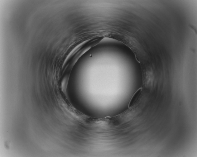 X0000099510236200805151507