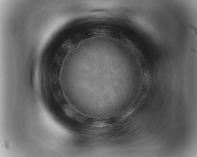 X0000099510381200805151506