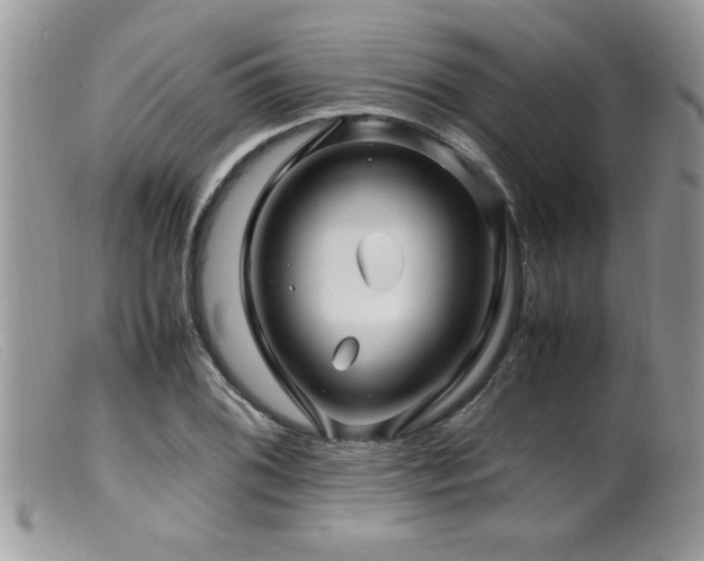 X0000099511076200805151454