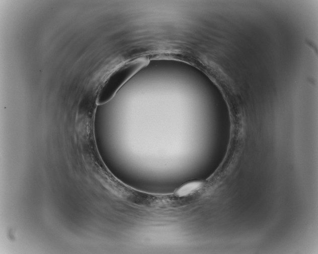 X0000099511169200805151452