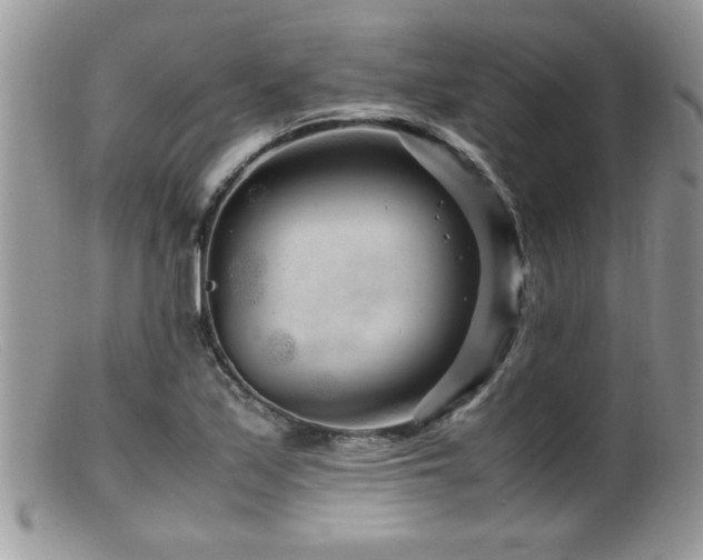 X0000099511171200805151452