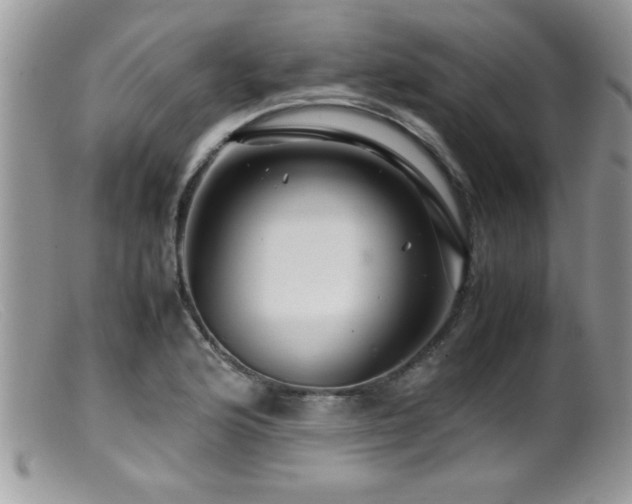 X0000099511176200805151452