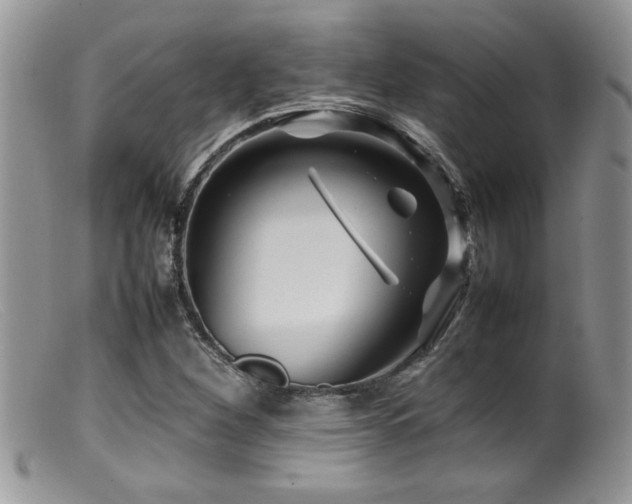 X0000099511260200805151451