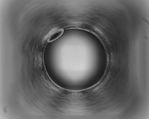 X0000099511354200805151449