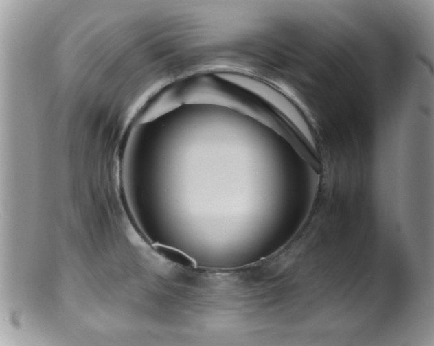 X0000099511476200805151448