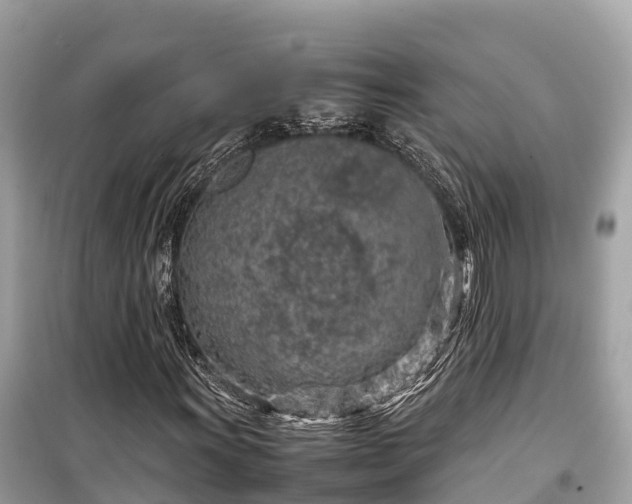 X0000099511011200805221417