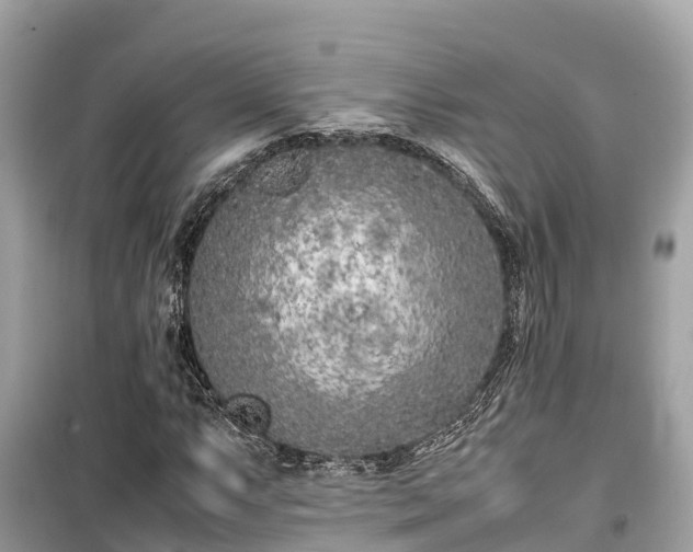 X0000099511063200805221417