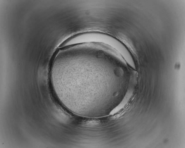 X0000099510156200805291157