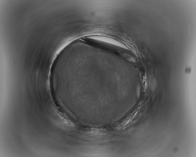 X0000099510292200805291155