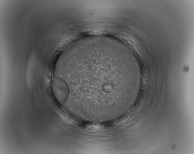 X0000099510503200805291152