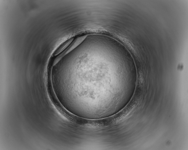 X0000099510630200805291150