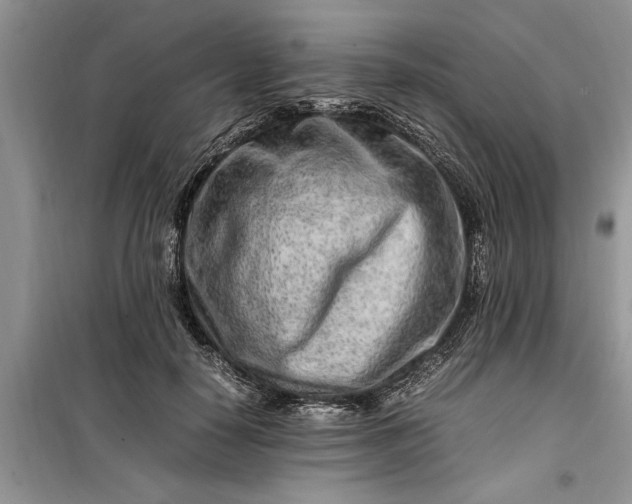 X0000099510650200805291150