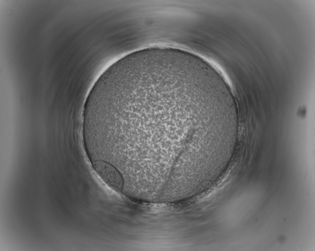 X0000099510903200805291147