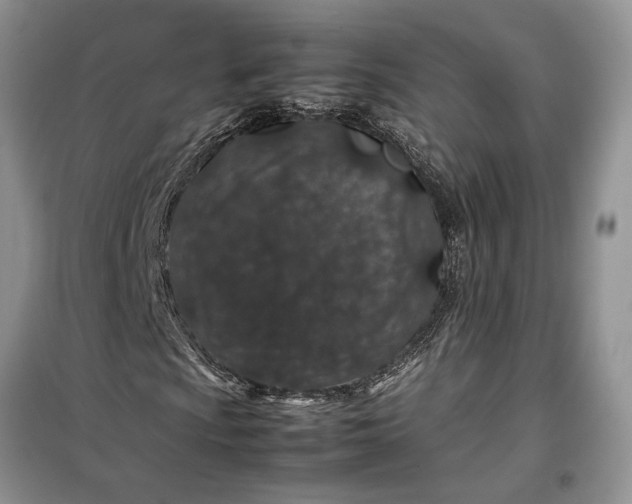 X0000099511009200805291144