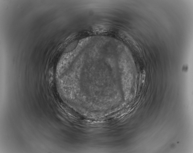 X0000099511011200805291144