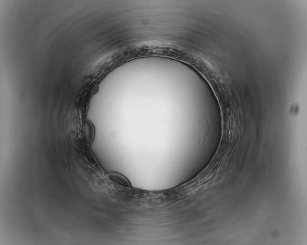 X0000099511062200805291144