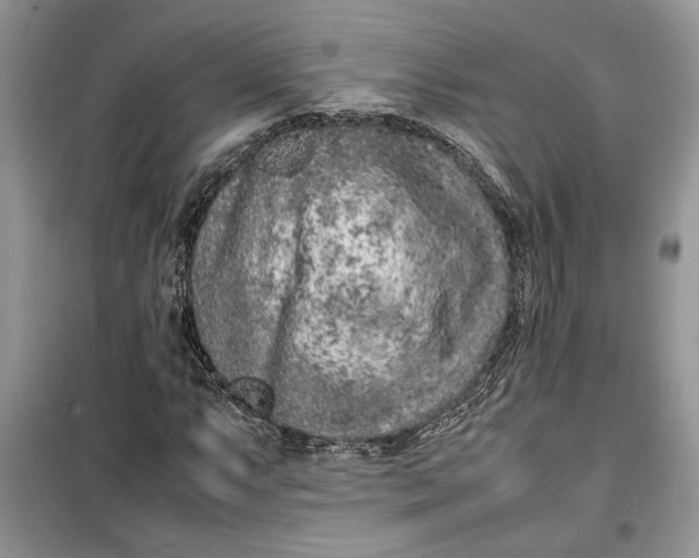 X0000099511063200805291144