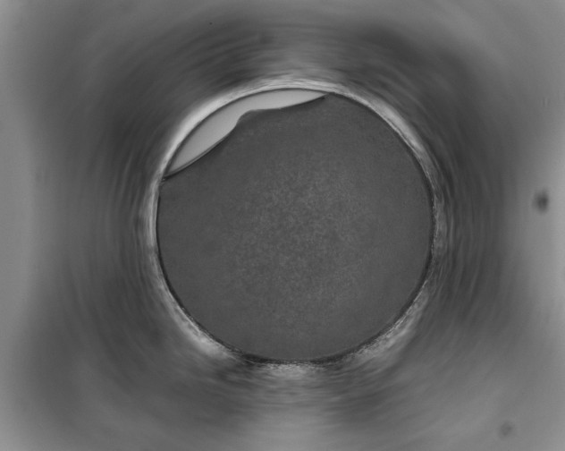 X0000099511246200805291142