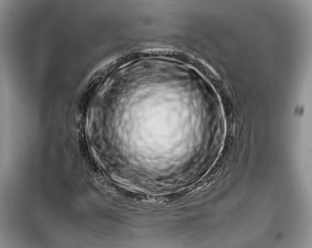X0000099511351200805291140