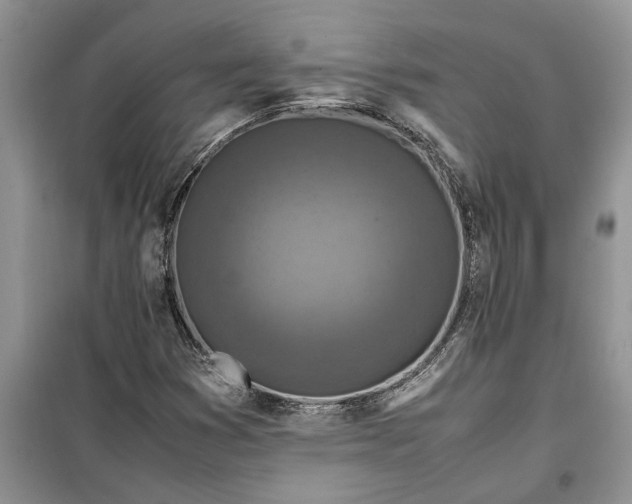 X0000099511353200805291140