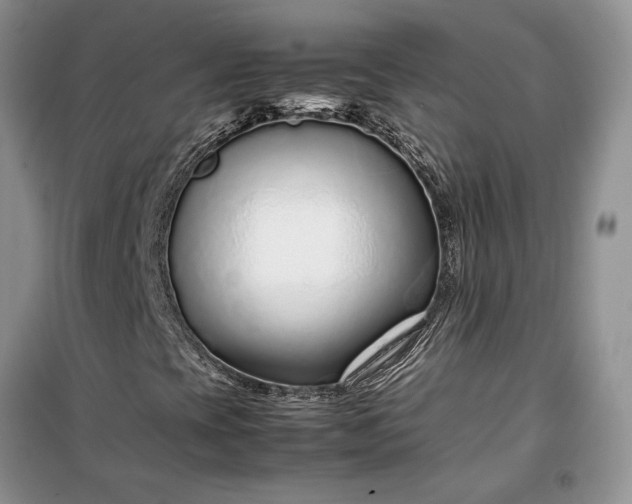 X0000099511393200805291139