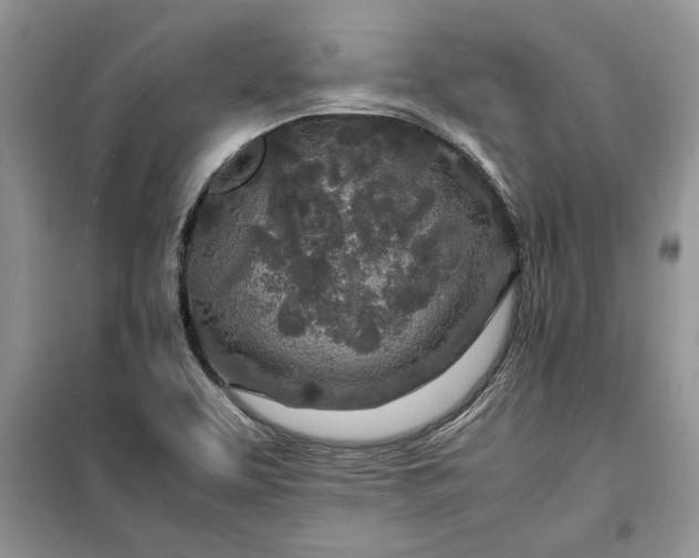 X0000099511463200805291139