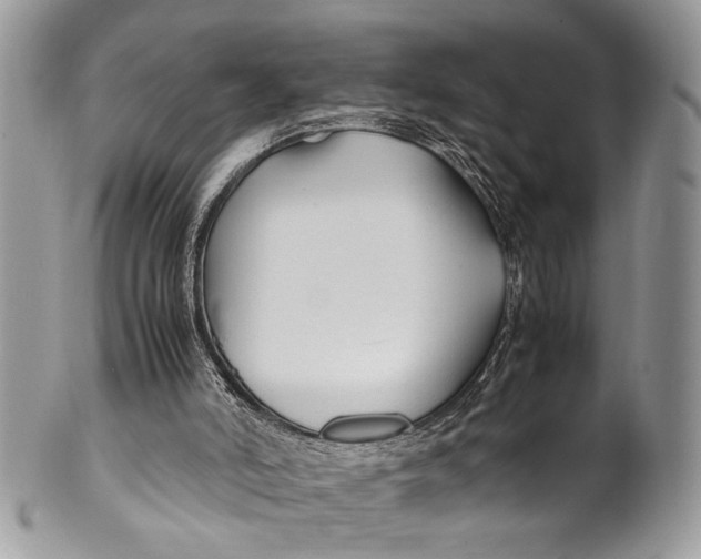 X0000099510006200806051158