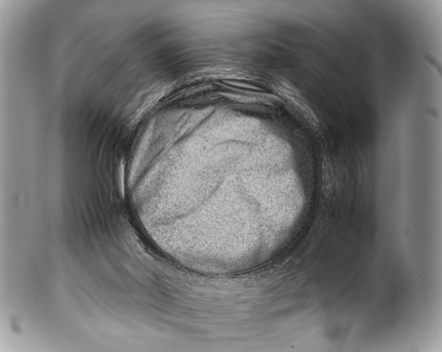 X0000099510014200806051158