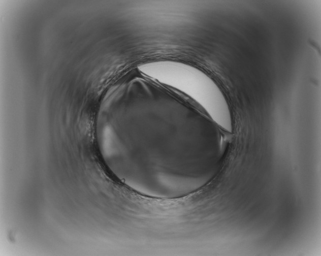 X0000099510031200806051158