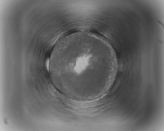 X0000099510047200806051157