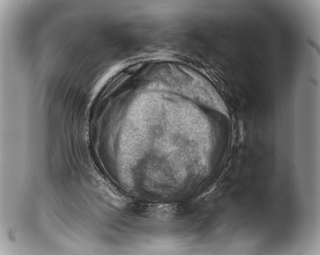 X0000099510056200806051157