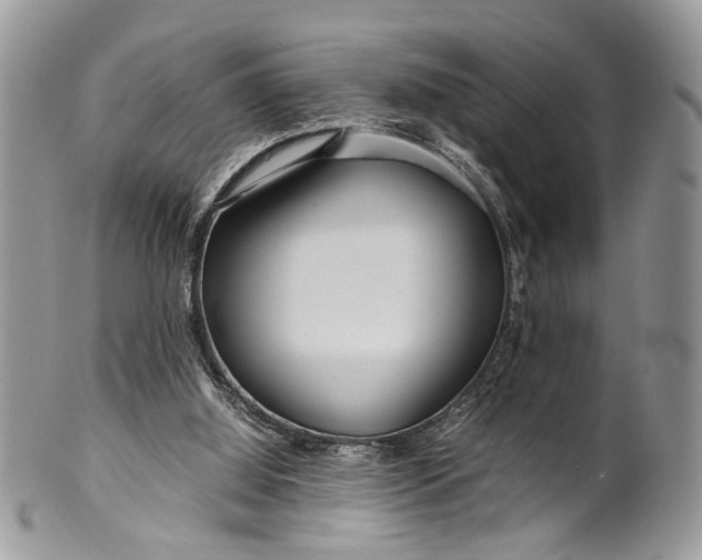 X0000099510060200806051157