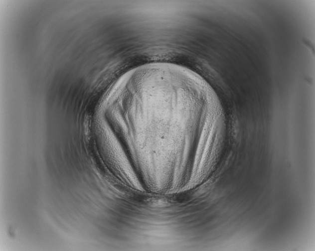 X0000099510074200806051157