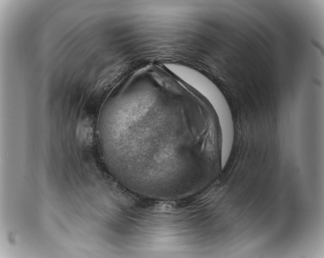 X0000099510080200806051157