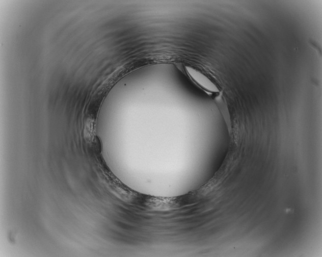 X0000099510093200806051157