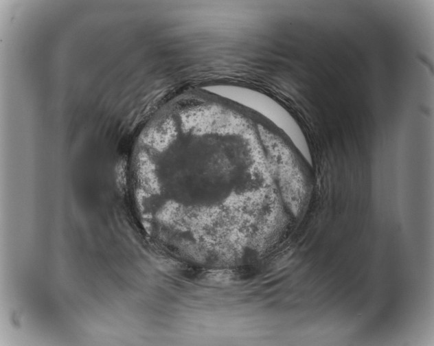 X0000099510127200806051156