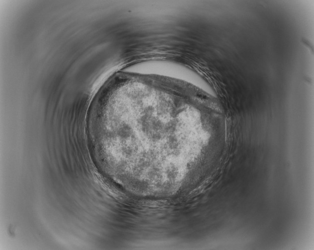 X0000099510147200806051155