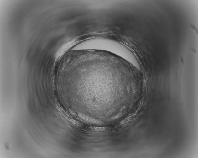 X0000099510149200806051155