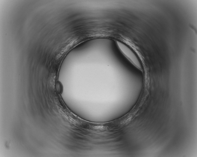 X0000099510153200806051155