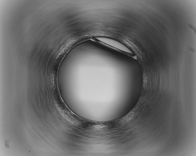 X0000099510158200806051155