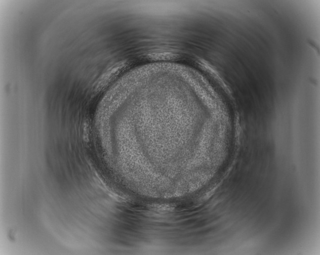 X0000099510161200806051155