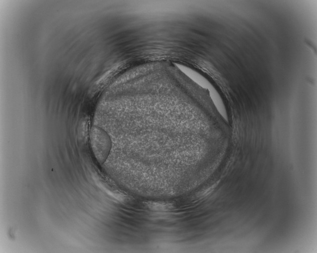 X0000099510165200806051155