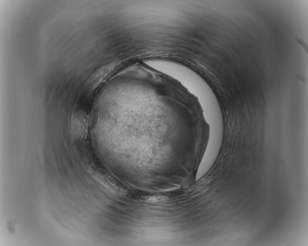 X0000099510168200806051155