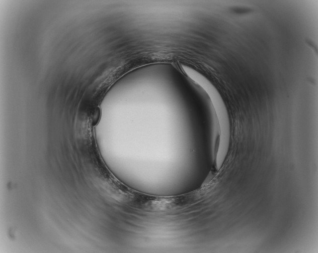 X0000099510172200806051156