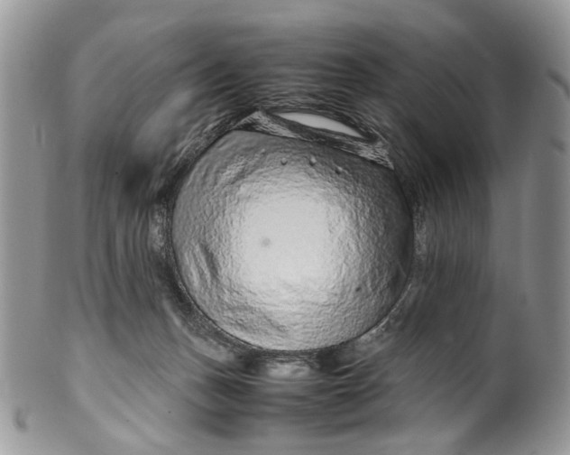 X0000099510175200806051156