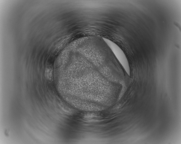 X0000099510177200806051156