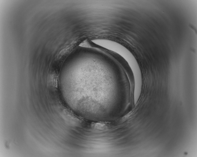 X0000099510180200806051156