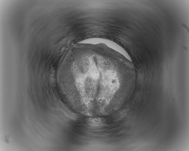 X0000099510181200806051156