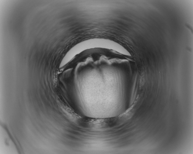 X0000099510186200806051156